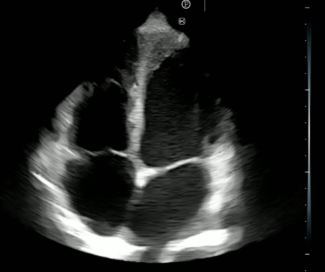 Heart