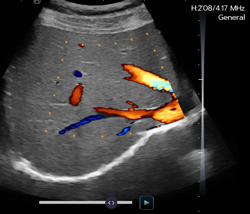 Liver