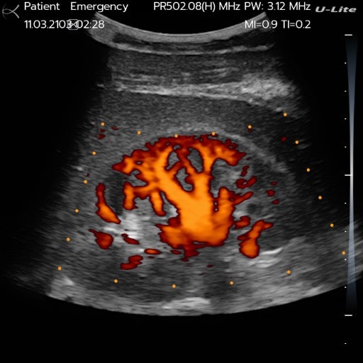 Kidney
